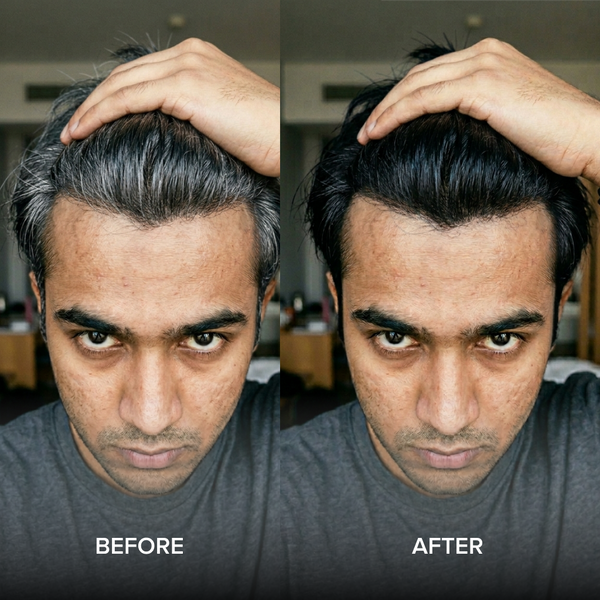 before after image