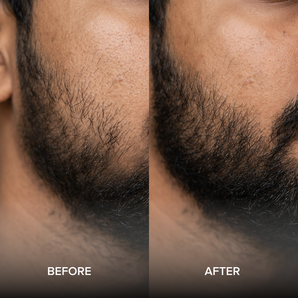 before after image